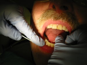 Dental_Hygienist_flossing_properly_Best_Dental_FLosser